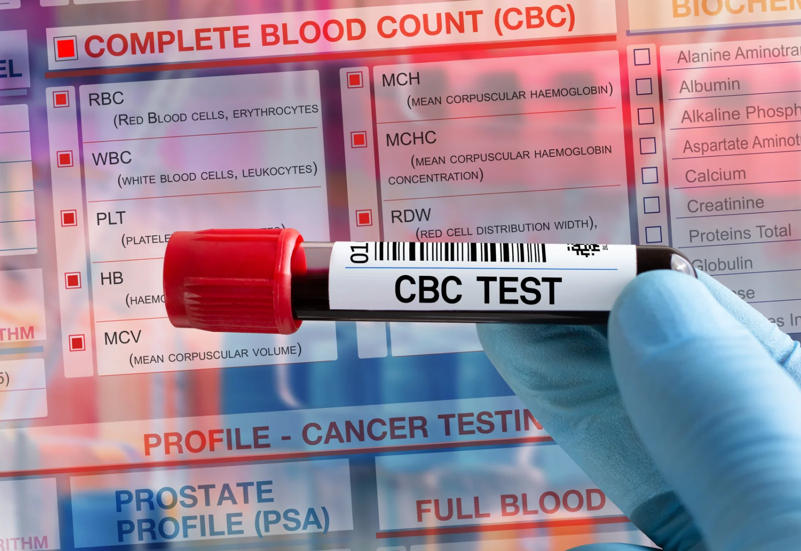 What does high ESR blood test mean? - Cura4U