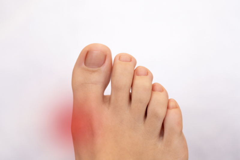 Uric acid home testing kits recommended by people with gout - Gout Scout